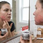 Teen skin isn't ready for every adult acne product. Learn why, and see the gentler routine that actually works for still-developing skin.