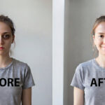 girl before dark circles and after treatment, without dark circle.