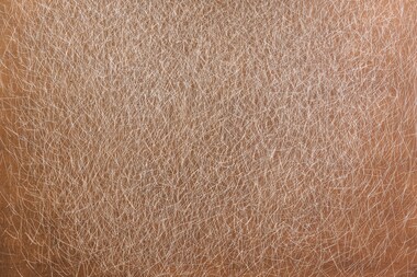 dry skin solution and actual cause
